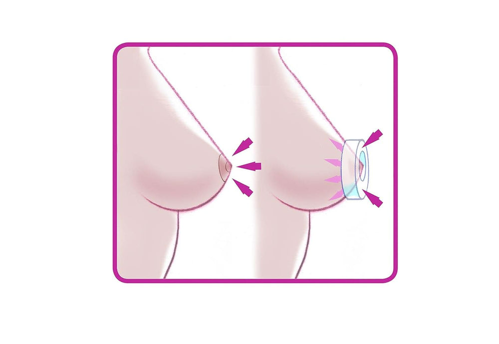 ELANEE Brust-Ringe, Schutz Der Brustwarze Bh-Kontakt Durch Hohllagerung, Ideal Bei Wunden, Entzündeten Brustwarzen Durch Stillen, 10 Stück (222-00) Zubehör Lebensmittel und Stillen Bebe Naty Shop