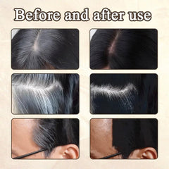 2 bucăți de pudră pentru linia părului maro închis, pudră pentru linia părului, concealer pentru linia părului, creioane pentru culoarea părului cu pieptene, instrument pentru acoperirea părului gri pentru femei și bărbați (40g, maro închis) Vopsea pentru par Naty Shop